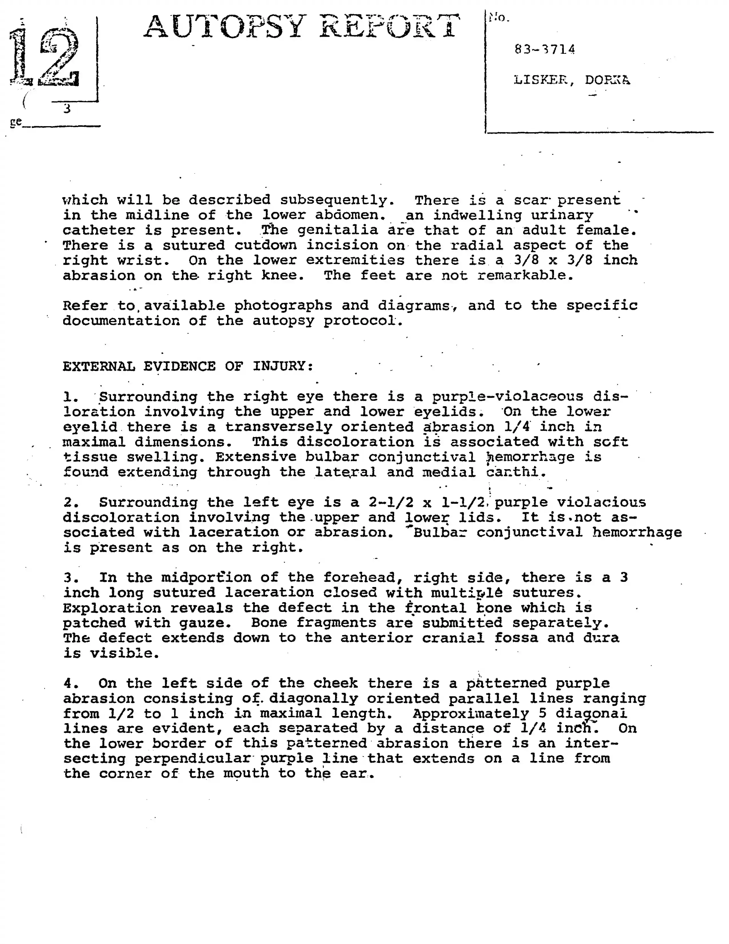 Autopsy Report, page 3
